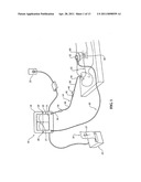 Guiding insert assembly for a catheter used with a catheter position guidance system diagram and image