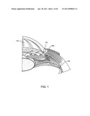 GLAUCOMA TREATMENT DEVICE diagram and image