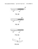 GLAUCOMA TREATMENT DEVICE diagram and image