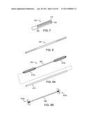 GLAUCOMA TREATMENT DEVICE diagram and image