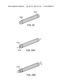 GLAUCOMA TREATMENT DEVICE diagram and image