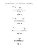 GLAUCOMA TREATMENT DEVICE diagram and image