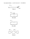 GLAUCOMA TREATMENT DEVICE diagram and image