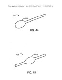 GLAUCOMA TREATMENT DEVICE diagram and image