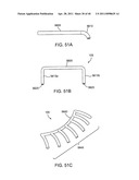 GLAUCOMA TREATMENT DEVICE diagram and image