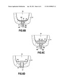 ULTRASONIC TIP FOR SINUS MEMBRANE ELEVATION diagram and image