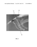 VISUAL INDICATION OF RUPTURE OF DRUG RESERVOIR diagram and image