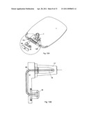 Moulded Connection between Cannula and Delivery Part diagram and image