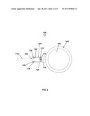 IMPLANTABLE PORT WITH A PIVOTABLY COUPLED STEM diagram and image