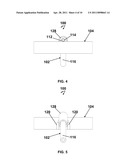 IMPLANTABLE PORT WITH A PIVOTABLY COUPLED STEM diagram and image