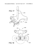 Eye dropper alignment apparatus and method for using same diagram and image