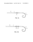 BALLOON CATHETER AND METHODS FOR PERICARDIOCENTESIS AND PERCUTANEOUS PERICARDIOTOMY diagram and image