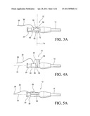 Locking Assembly for a Drainage Catheter diagram and image