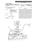 Cam Action Detachment for Tracheostomy Tube diagram and image