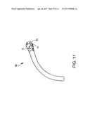 Cam Action Detachment for Tracheostomy Tube diagram and image