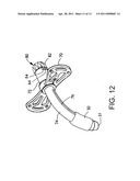 Cam Action Detachment for Tracheostomy Tube diagram and image