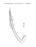 METHODS FOR REMOVING KIDNEY STONES FROM THE URETER diagram and image