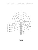 System and Method for Monitoring Ablation Size diagram and image