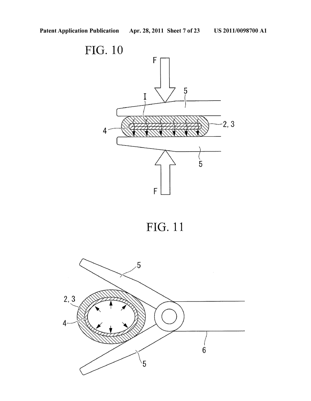 Biological-tissue joining apparatus - diagram, schematic, and image 08