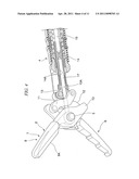 HIGH-FREQUENCY TREATMENT INSTRUMENT diagram and image