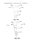 Stereotactic Therapy System diagram and image