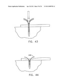 APPARATUS AND METHOD FOR ATTACHING SOFT TISSUE TO BONE diagram and image