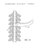 METHODS AND APPARATUS FOR VASCULAR PROTECTION IN SPINAL SURGERY diagram and image