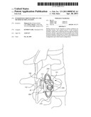 INTERSPINOUS PROCESS IMPLANT AND METHOD OF IMPLANTATION diagram and image