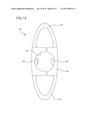 INTERSPINOUS PROCESS IMPLANT AND METHOD OF IMPLANTATION diagram and image