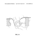 Methods and Apparatus For Treating Spinal Stenosis diagram and image