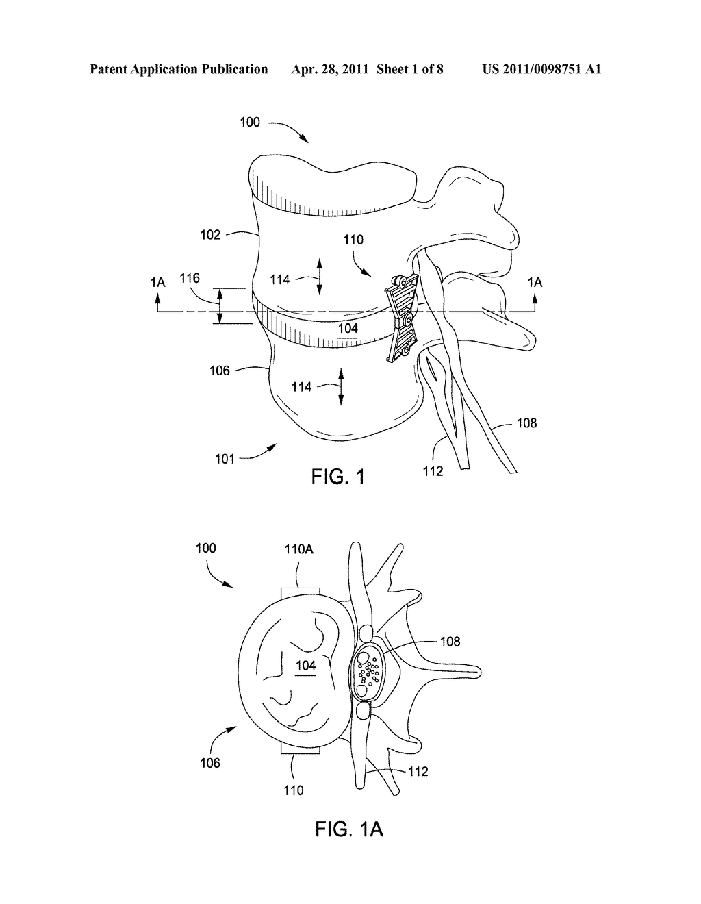 APPARATUS FOR COMPRESSING OR DECOMPRESSING A SPINAL DISC AND METHOD OF USE THEREOF - diagram, schematic, and image 02