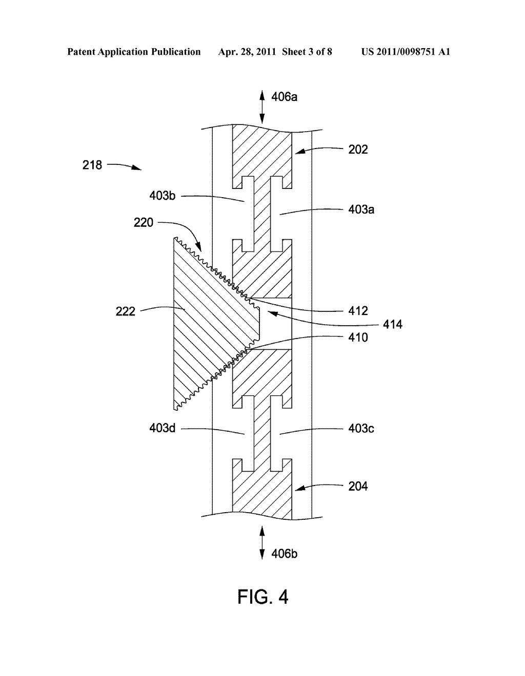 APPARATUS FOR COMPRESSING OR DECOMPRESSING A SPINAL DISC AND METHOD OF USE THEREOF - diagram, schematic, and image 04