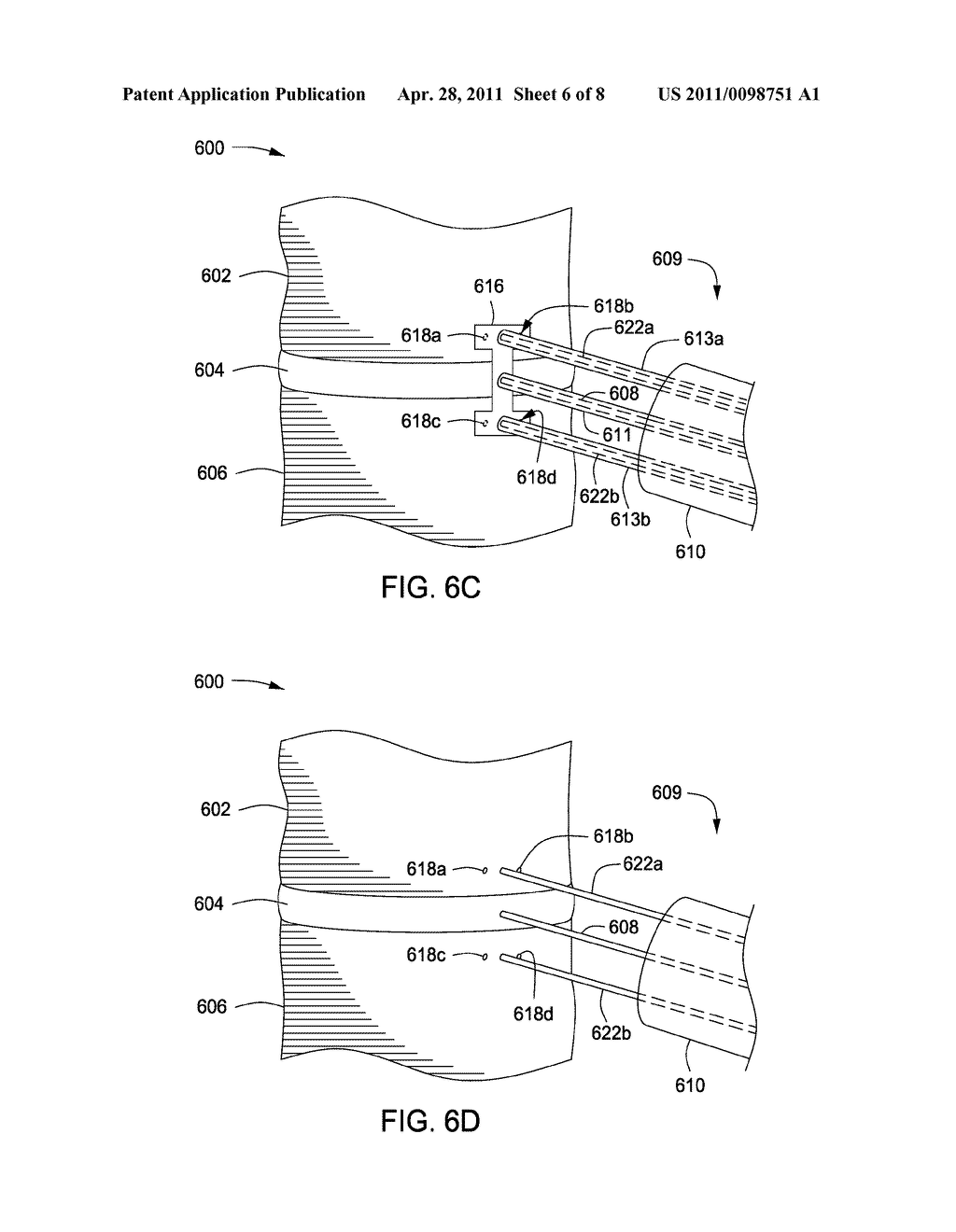 APPARATUS FOR COMPRESSING OR DECOMPRESSING A SPINAL DISC AND METHOD OF USE THEREOF - diagram, schematic, and image 07