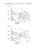 APPARATUS FOR COMPRESSING OR DECOMPRESSING A SPINAL DISC AND METHOD OF USE THEREOF diagram and image