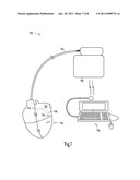 CARDIAC RHYTHM MANAGEMENT SYSTEM AND METHOD diagram and image