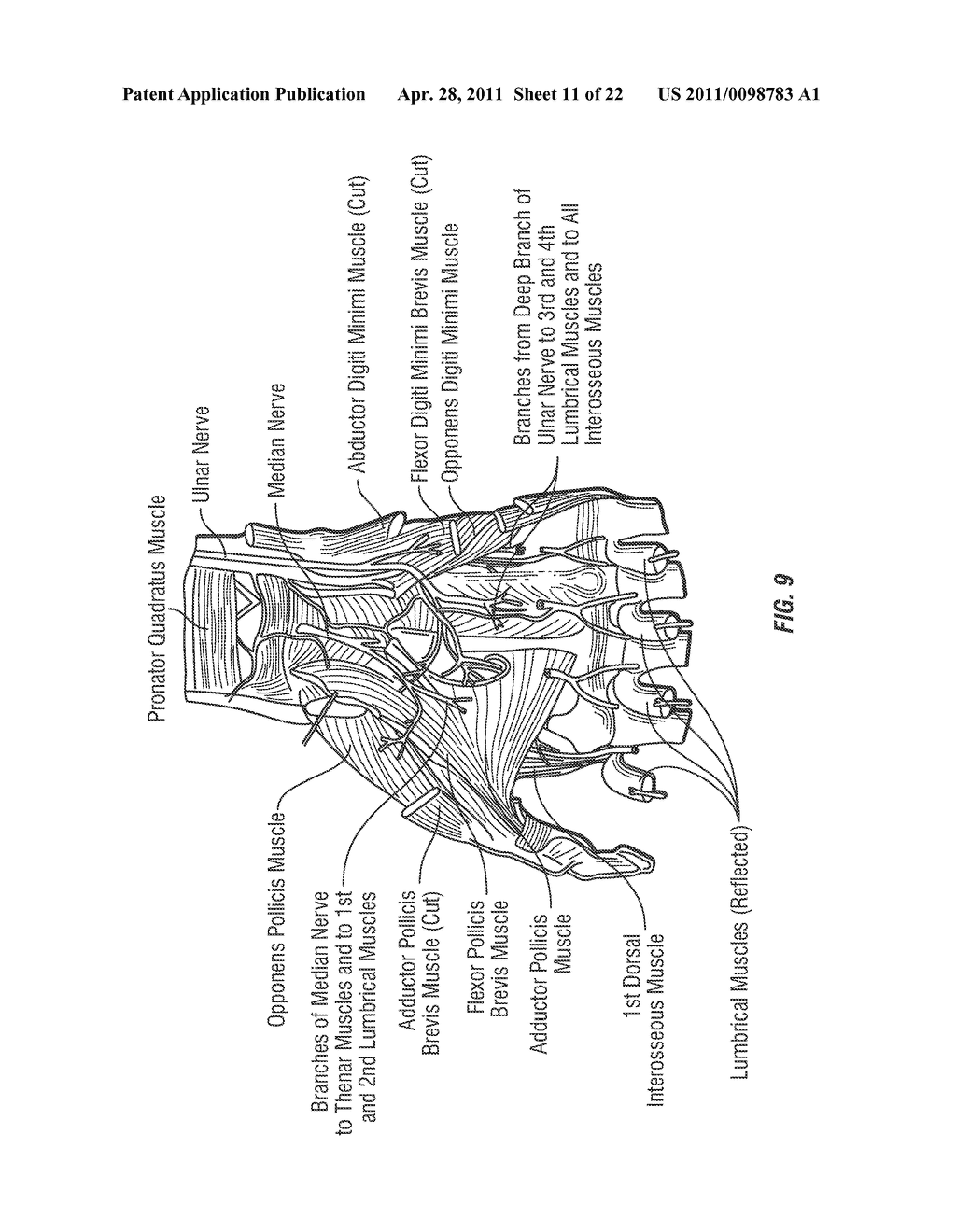 METHOD AND SYSTEM TO REGULATE ARMS, LEGS, HANDS AND OTHER SKELETAL MUSCLES BY NEURO-ELECTRICAL CODED SIGNALS - diagram, schematic, and image 12