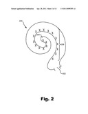 Fully Implantable Cochlear Implant Systems Including Optional External Components and Methods for Using the Same diagram and image