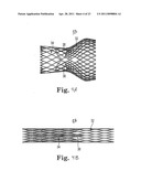 STENTED TRANSCATHETER PROSTHETIC HEART VALVE DELIVERY SYSTEM AND METHOD diagram and image