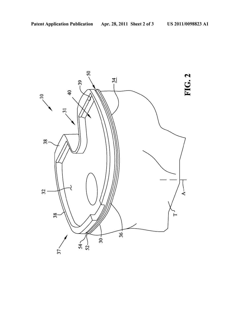 TIBIAL COMPONENT WITH FLEXIBLE RIM - diagram, schematic, and image 03