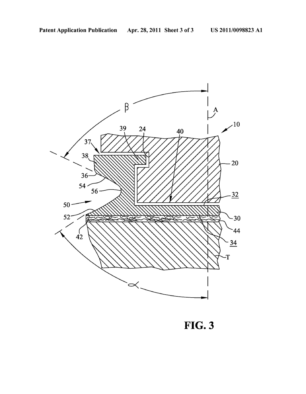 TIBIAL COMPONENT WITH FLEXIBLE RIM - diagram, schematic, and image 04