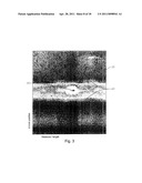  Program Product to Screen for Longitudinal-Seam Anomalies diagram and image