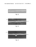  Program Product to Screen for Longitudinal-Seam Anomalies diagram and image