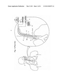 METHOD OF DETECTING ENDOTRACHEAL TUBE MISPLACEMENT diagram and image