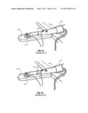 Limb supporting apparatus diagram and image