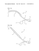 FLUID FILLED IMPLANTS FOR TREATING OBSTRUCTIVE SLEEP APNEA diagram and image