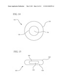 FLEXIBLE IMPLANTS HAVING INTERNAL VOLUME SHIFTING CAPABILITIES FOR TREATING OBSTRUCTIVE SLEEP APNEA diagram and image