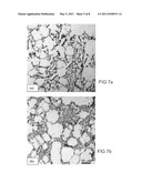 ALUMINIUM BASED CASTING ALLOY diagram and image