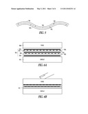 REDUNDANT TOUCHSCREEN ELECTRODES diagram and image