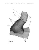 SYSTEM AND METHOD FOR AUTOMATIC DETECTION OF TIP PLANE ON 3D DETAILED EAR IMPRESSIONS diagram and image