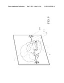 THREE-DIMENSIONAL DIGITAL MAGNIFIER OPERATION SUPPORTING SYSTEM diagram and image